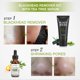thumbnail image 3 of Mascarilla facial peel off para puntos negros SHVYOG con brocha y aceite de árbol de té, 3 of 9
