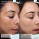 thumbnail image 2 of Tratamiento de hiperpigmentación Sente Cysteamine HSA 50 ml, 2 of 3