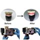 thumbnail image 5 of Kit de ayuda a la fotografía dental Impressive Smile con luz de relleno, 5 of 8