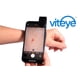 thumbnail image 3 of Accesorio dermatoscopio para smartphone 4x de aumento con app, 3 of 6