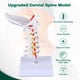 thumbnail image 3 of Modelo de Columna Cervical Ultrassist a Tamaño Natural para Enseñanza Médica, 3 of 7