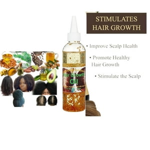 Organic Hair Solution - -Hair Growth Solución Capilar Orgánica Aceite Fortalecedor Del Cuero Cabelludo Y El Cabello -Para Cabello Más Fuerte, Más Grueso Y Largo-Para Puntas Abiertas Y Cuero Cabelludo Seco-(8Oz)