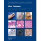 thumbnail image 1 of Libro de la Organización Mundial de la Salud sobre Tumores Cutáneos, 1 of 1