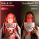 thumbnail image 2 of Máscara de tratamiento facial Halo LED inalámbrica de Hatch Therapies, 2 of 8