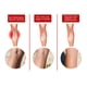 thumbnail image 2 of Varicose Vein Patch Circulation Paste for Legs Soothing Leg Treat Improves The Appearance of Varicose Vein Personal Health Care, 2 of 3