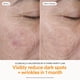 thumbnail image 4 of Suero Skinfix Brighten + Firm con 15% de vitamina C 30 mL para el rostro, 4 of 9