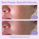 thumbnail image 4 of Spray tónico facial YEOUTH Hydrating con camomila y alantoína, 100 ml, 4 of 8