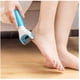 thumbnail image 1 of Removedor Extractor De Callos Maquina Exfoliadora, 1 of 4