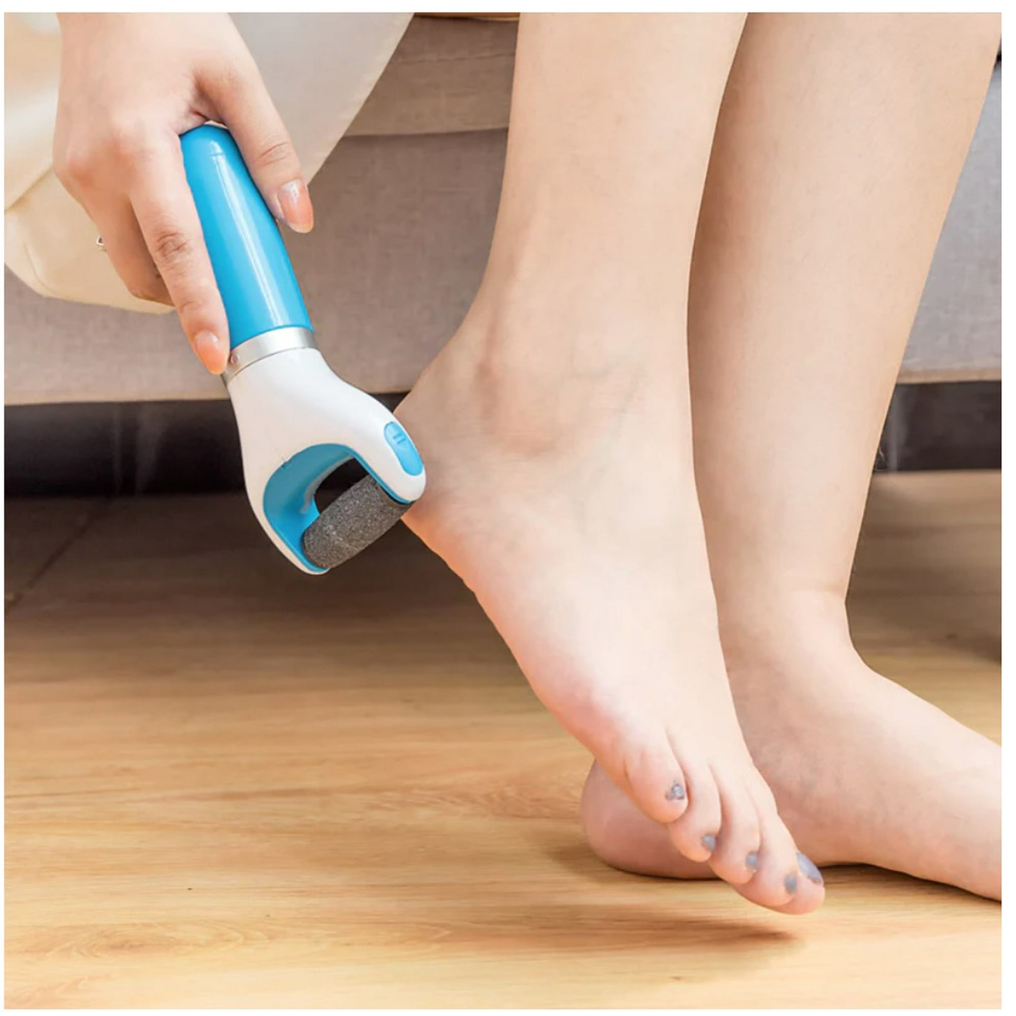 Tomasstore - Removedor Extractor De Callos Maquina Exfoliadora