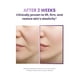 thumbnail image 4 of Set de cuidado de la piel BIOHEAL BOH Probioderm 3D Lifting Size Travel Size, 4 of 8