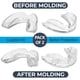 thumbnail image 5 of Protectores bucales deportivos profesionales Sparkling White Smiles, 2 piezas, 5 of 9