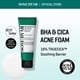 thumbnail image 2 of Jabón facial SOME BY MI AHA BHA PHA 30 días Miracle Acne 100 ml, 2 of 7