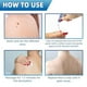 thumbnail image 4 of Removedor Crema De Verrugas Tratamiento Indoloro, 4 of 8