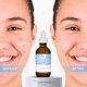 thumbnail image 4 of Sérum Cosmedica Skincare con ácido hialurónico + B5, 60 ml, antienvejecimiento, 4 of 7