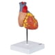 thumbnail image 3 of Modelo anatómico de corazón Axis Scientific Deluxe a tamaño natural, 3 of 9
