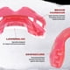 thumbnail image 3 of Protector bucal SAFEJAWZ para aparatos ortopédicos Ortho Series Ice Pink, 3 of 6