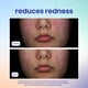 thumbnail image 4 of Spray Facial de Ácido Hipocloroso Skin Spritz Method 250 ml, 4 of 9