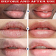 thumbnail image 2 of Remove Dark Lip Balm Lightening Melanin Mask Gloss Oil Exfoliating Clean Moisturizer Korean Care Products Makeup Beauty Health, 2 of 3