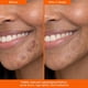thumbnail image 5 of Suero Lion Pose Unspotted 4X Corrector de Manchas Oscuras 30 ml, 5 of 7