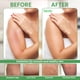 thumbnail image 5 of Manoplas Coreanas Exfoliantes Modu para Toalla 4PCS Viscosa Vegana, 5 of 7