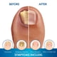 thumbnail image 4 of Tratamiento para uñas ProClearz Brite Now 15 ml, efecto iluminador, 4 of 6