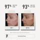 thumbnail image 3 of Tónico Facial RODAN + FIELDS 125 ml Unblemish, 3 of 5