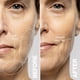 thumbnail image 4 of Dispositivo exfoliante antienvejecimiento Dermaflash LUXE+ para depilación, 4 of 5