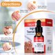 thumbnail image 2 of Gotas Treatonic para tratamiento de uñas encarnadas, paquete de 2 con punteras, 2 of 6