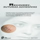 thumbnail image 1 of Recovery Sutura Adhesivas - Ayuda A Cerrar Cortes En La Piel, 1 of 3