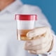 thumbnail image 3 of Paquete Recolector De Heces Muestra Laboratorio Lau, 3 of 3