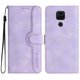 thumbnail image 1 of Funda FOXDOCK para Xiaomi Redmi Note 9 -Diseño elegante,Ideal para hombres y mujeres, 1 of 5