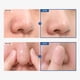 thumbnail image 3 of Aceite limpiador TOSOWOONG AHA Blackhead Out 150 ml con aceite de árbol de té, 3 of 6