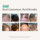 thumbnail image 2 of Serum Capilar Happy Head 60 ml Procapil Biotin Leave-In, 2 of 3