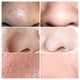 thumbnail image 3 of LANBENA Blackhead Remover Mask Serum Shrink Pores Acne Treatment Essence Deep Cleaning Purifying Smooth Skin Care Beauty 100pcs, 3 of 3