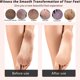 thumbnail image 5 of Raspador de Pies ICANdOIT 4 en 1 de Bambú para Pedicura, 5 of 9