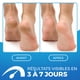 thumbnail image 2 of Crema para pies Imperial Feet 2 en 1 XL, reparadora de pies para pies secos, 2 of 8