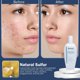 thumbnail image 4 of Jabón de Azufre JOESOEF SKIN CARE 2 unidades – Tratamiento para el acné, 4 of 6