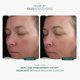 thumbnail image 3 of Loción facial RosaLieve 30 ml de Marini SkinSolutions, 3 of 6