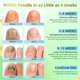 thumbnail image 3 of Pluma de tratamiento para uñas ONIADBA 6×5 ml de alta potencia, 3 of 6