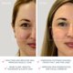 thumbnail image 5 of Dispositivo facial FOREO BEAR Mini para esculpir la cara con microcorriente, 5 of 6