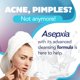 thumbnail image 2 of Jabón Asepxia Exfoliante para Acné - Pack de 5 (113 g), 2 of 8