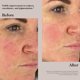 thumbnail image 5 of Serum Beauty Peptide Serum 30 Ml Firmeza Antienvejecimiento, 5 of 7