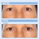 thumbnail image 3 of Sérum de retinol Serious Skincare Vitamina A Force XR, 30 ml, 3 of 7