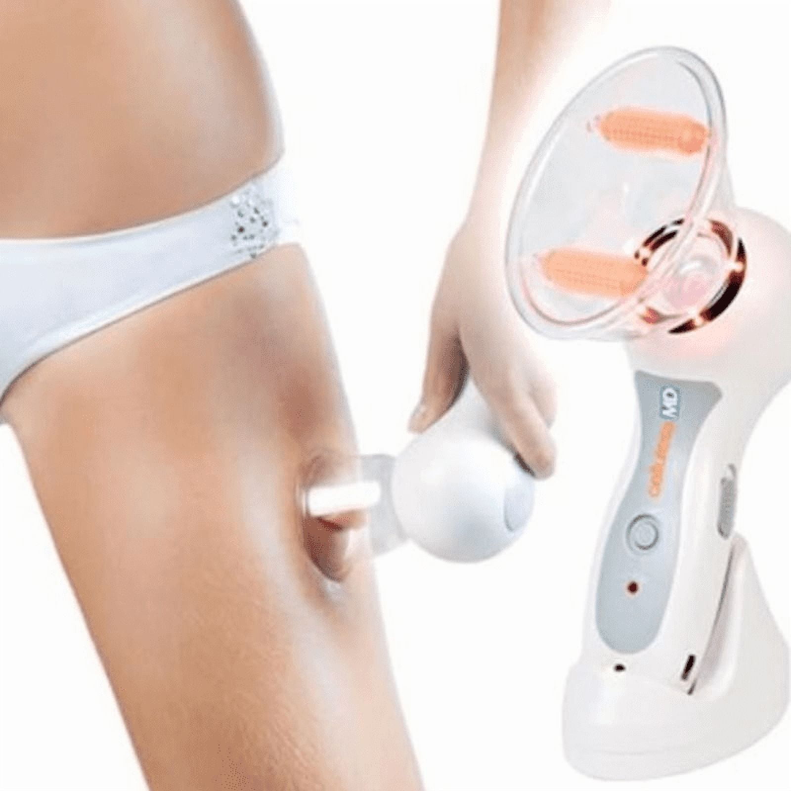 Movi - Masajeador Celluless Md Anticelulítico Con Succión Y Rodillos