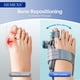 thumbnail image 5 of Corrector de juanetes HEMEXS 3D ajustable para mujeres y hombres, 5 of 9
