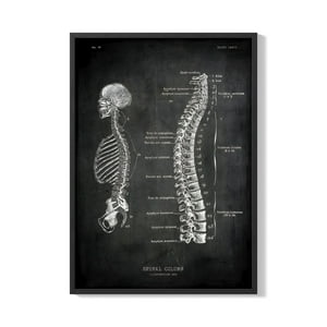 Creango - Cuadro Poster Enmarcado Cuerpo Humano Espinal Dorsal Decorativo