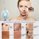 thumbnail image 5 of Vaporizador facial Vous Nano Ionic Ozone para esteticista, 5 of 9
