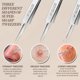 thumbnail image 3 of Teenitor 9 Pcs Professional Blackhead Tweezers and Pimple Pore Tool Kit, 3 of 3
