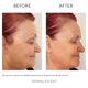 thumbnail image 3 of Suero Facial Dermalescent 30 ml Vitamina E y C, 3 of 6