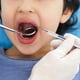 thumbnail image 4 of Raspador de sarro dental profesional Equinox, herramienta para eliminar placa y restos de comida., 4 of 5